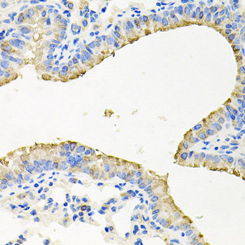 Immunohistochemistry of paraffin-embedded Rat Intestine using RBBP5 Polyclonal Antibody at dilution of  1:100 (40x lens).