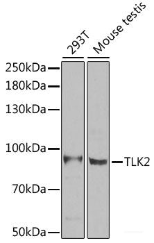 Immunohistochemistry of paraffin-embedded Human prostate using SGCB Polyclonal Antibody at dilution of  1:100 (40x lens).