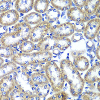 Immunohistochemistry of paraffin-embedded Rat heart using SGCD Polyclonal Antibody at dilution of  1:100 (40x lens).