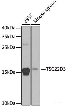Immunohistochemistry of paraffin-embedded Rat liver using TROVE2 Polyclonal Antibody at dilution of  1:100 (40x lens).