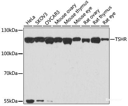 Immunohistochemistry of paraffin-embedded Human colon carcinoma using SSX2 Polyclonal Antibody at dilution of  1:200 (40x lens).