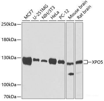 Immunohistochemistry of paraffin-embedded Mouse kidney using TARS Polyclonal Antibody at dilution of  1:100 (40x lens).