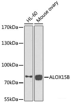Immunohistochemistry of paraffin-embedded Human gastric damage using ASMTL Polyclonal Antibody at dilution of  1:100 (40x lens).