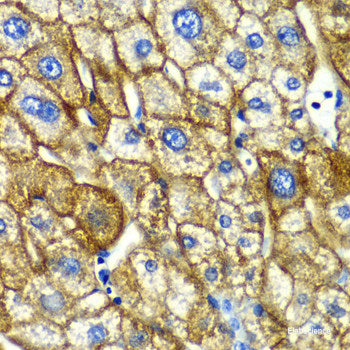 Immunohistochemistry of paraffin-embedded Rat lung using EIF2B2 Polyclonal Antibody at dilution of  1:100 (40x lens).