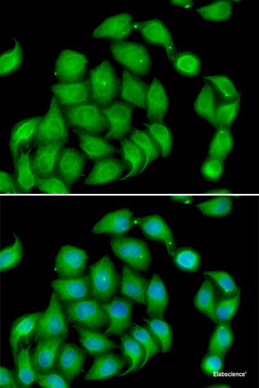Immunohistochemistry of paraffin-embedded Rat brain using DNAJA3 Polyclonal Antibody at dilution of  1:100 (40x lens).
