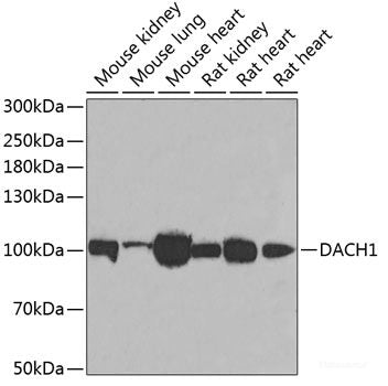 Immunohistochemistry of paraffin-embedded Mouse brain using QKI Polyclonal Antibody at dilution of  1:100 (40x lens).