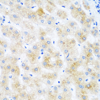 Immunohistochemistry of paraffin-embedded Human kidney using mH2A1 Polyclonal Antibody at dilution of  1:100 (40x lens).