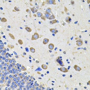 Immunohistochemistry of paraffin-embedded Rat spinal cord using DPP3 Polyclonal Antibody at dilution of  1:100 (40x lens).