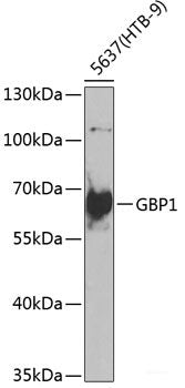 Immunohistochemistry of paraffin-embedded Rat brain using PDIA6 Polyclonal Antibody at dilution of  1:100 (40x lens).