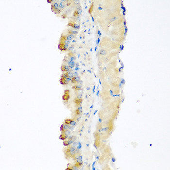 Immunofluorescence analysis of C6 cells using STAM2 Polyclonal Antibody at dilution of  1:100. Blue: DAPI for nuclear staining.