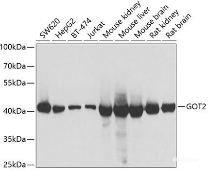 Immunohistochemistry of paraffin-embedded Rat brain using PIAS3 Polyclonal Antibody at dilution of  1:100 (40x lens).