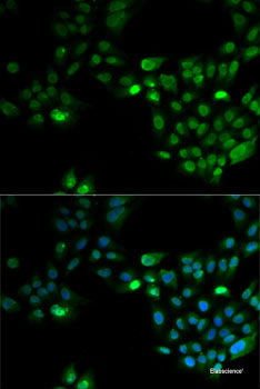 Immunohistochemistry of paraffin-embedded Rat liver using FASTK Polyclonal Antibody at dilution of  1:100 (40x lens).