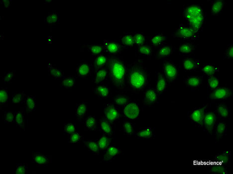 Immunohistochemistry of paraffin-embedded Human stomach using SUB1 Polyclonal Antibody at dilution of  1:100 (40x lens).