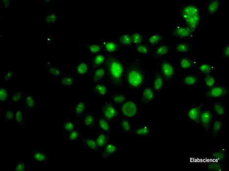 Immunohistochemistry of paraffin-embedded Human stomach using SUB1 Polyclonal Antibody at dilution of  1:100 (40x lens).