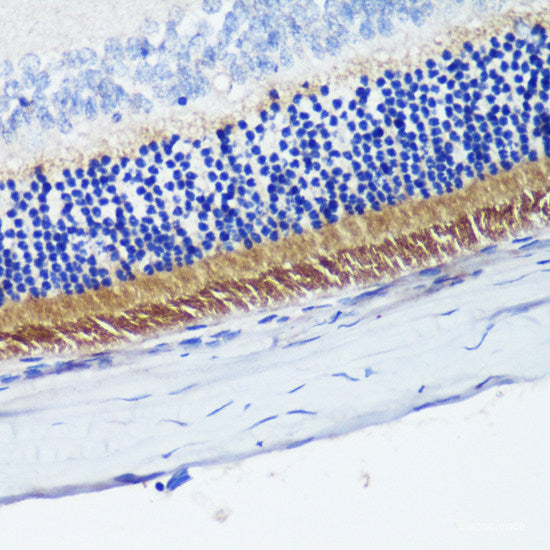 Immunohistochemistry of paraffin-embedded Human colon using LMOD1 Polyclonal Antibody at dilution of  1:200 (40x lens).
