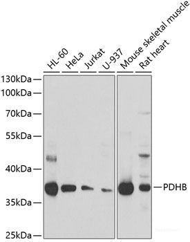 Immunohistochemistry of paraffin-embedded Rat brain using CLIC4 Polyclonal Antibody at dilution of  1:100 (40x lens).