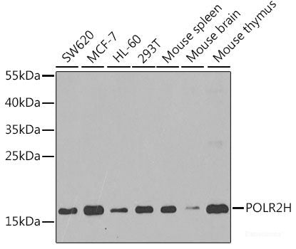 Immunohistochemistry of paraffin-embedded Rat brain using LDLRAP1 Polyclonal Antibody at dilution of  1:100 (40x lens).