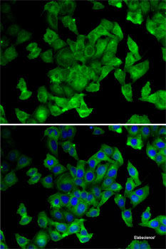 Immunohistochemistry of paraffin-embedded Human lung cancer using TRMT2A Polyclonal Antibody at dilution of  1:100 (40x lens).