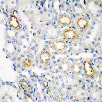 Immunohistochemistry of paraffin-embedded Mouse lung using SERPINA10 Polyclonal Antibody at dilution of  1:100 (40x lens).