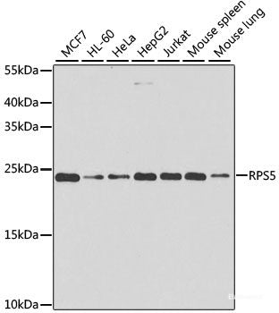Immunohistochemistry of paraffin-embedded Human lung cancer using TRMT1 Polyclonal Antibody at dilution of  1:100 (40x lens).
