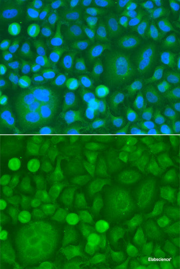 Immunohistochemistry of paraffin-embedded Rat kidney using CCL26 Polyclonal Antibody at dilution of  1:200 (40x lens).