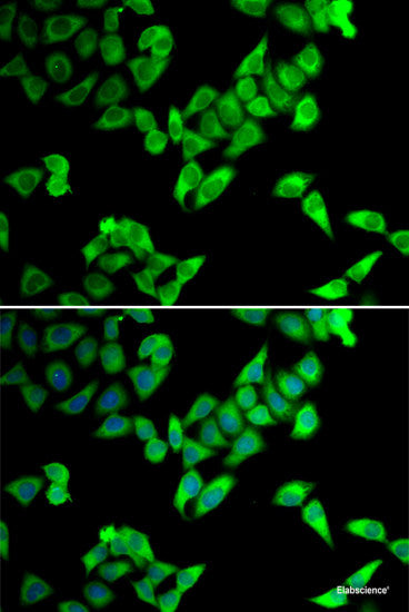 Immunohistochemistry of paraffin-embedded Rat brain using PTPRE Polyclonal Antibody at dilution of  1:100 (40x lens).