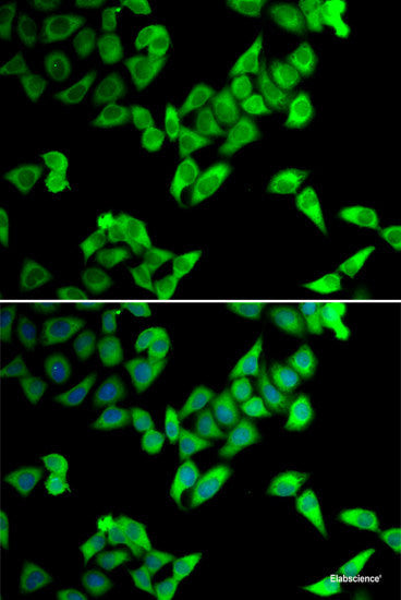 Immunohistochemistry of paraffin-embedded Rat brain using PTPRE Polyclonal Antibody at dilution of  1:100 (40x lens).