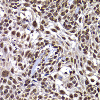 Immunohistochemistry of paraffin-embedded Human liver damage using TOB2 Polyclonal Antibody at dilution of  1:100 (40x lens).
