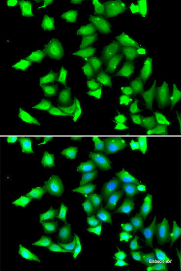 Immunohistochemistry of paraffin-embedded Human kidney using LZTR1 Polyclonal Antibody at dilution of  1:100 (40x lens).