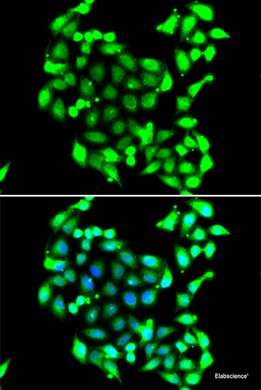Immunohistochemistry of paraffin-embedded Human liver damage using PEX3 Polyclonal Antibody at dilution of  1:100 (40x lens).