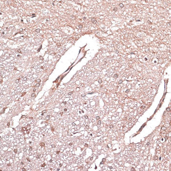 Immunohistochemistry of paraffin-embedded Rat kidney using PIP4K2A Polyclonal Antibody at dilution of  1:100 (40x lens).
