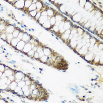 Immunohistochemistry of paraffin-embedded Rat brain using SAR1A Polyclonal Antibody at dilution of  1:100 (40x lens).