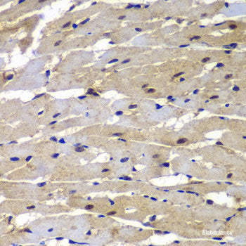 Immunohistochemistry of paraffin-embedded Mouse cerebellum using CA8 Polyclonal Antibody at dilution of  1:100 (40x lens).