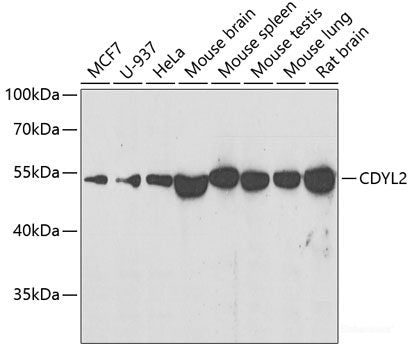 Immunohistochemistry of paraffin-embedded Rat heart using GLUT4 Polyclonal Antibody at dilution of  1:100 (40x lens).