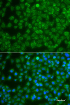Immunohistochemistry of paraffin-embedded Human stomach using FANCA Polyclonal Antibody at dilution of  1:100 (40x lens).