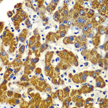 Immunohistochemistry of paraffin-embedded Human stomach using SYT4 Polyclonal Antibody at dilution of  1:100 (40x lens).