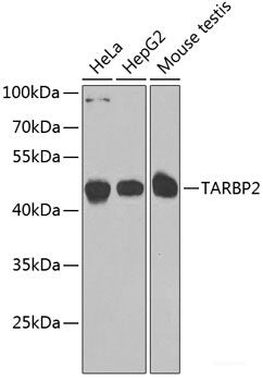Immunohistochemistry of paraffin-embedded Rat kidney using BSND Polyclonal Antibody at dilution of  1:100 (40x lens).