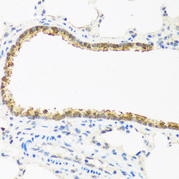 Immunofluorescence analysis of C6 cells using P70 S6K Polyclonal Antibody at dilution of  1:100.C6 cells were treated by Serum-starvation overnight at 37℃. Blue: DAPI for nuclear staining.