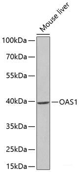 Immunohistochemistry of paraffin-embedded Mouse brain using MIP Polyclonal Antibody at dilution of  1:100 (40x lens).