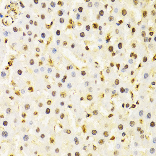 Immunofluorescence analysis of HeLa cells using RAB6A Polyclonal Antibody