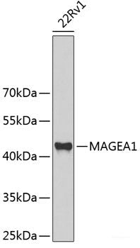 Immunohistochemistry of paraffin-embedded Mouse kidney using BNIP3 Polyclonal Antibody at dilution of  1:100 (40x lens).