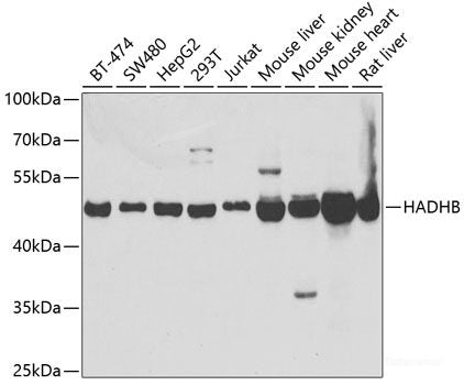Immunofluorescence analysis of NIH-3T3 cells using ETF1 Polyclonal Antibody at dilution of  1:100 (40x lens). Blue: DAPI for nuclear staining.