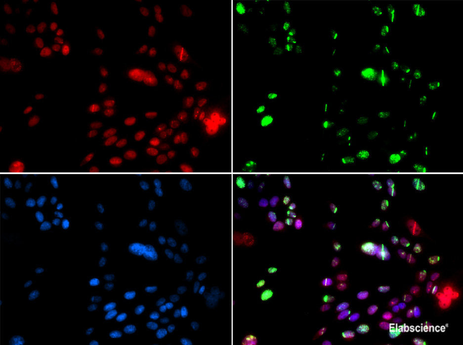 Immunohistochemistry of paraffin-embedded Human esophagus using Polyclonal AntibodyPC4 Polyclonal Antibody at dilution of  1:100 (40x lens).