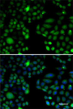 Immunohistochemistry of paraffin-embedded Mouse brain using PUM1 Polyclonal Antibody at dilution of  1:100 (40x lens).