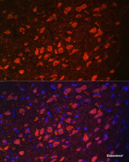 Immunofluorescence analysis of HeLa cells using GRP Polyclonal Antibody at dilution of  1:100. Blue: DAPI for nuclear staining.