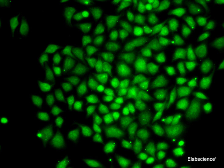 Immunohistochemistry of paraffin-embedded Human liver damage using MGAT1 Polyclonal Antibody at dilution of  1:100 (40x lens).