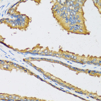 Immunohistochemistry of paraffin-embedded Human esophagus using TRIM27 Polyclonal Antibody at dilution of  1:100 (40x lens).