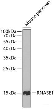 Immunofluorescence analysis of L929 cells using RPL11 Polyclonal Antibody at dilution of  1:100. Blue: DAPI for nuclear staining.