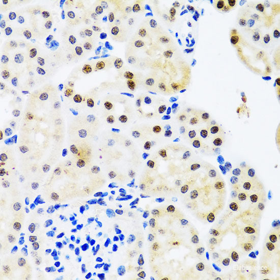 Immunohistochemistry of paraffin-embedded Rat liver using SNRPA Polyclonal Antibody at dilution of  1:100 (40x lens).