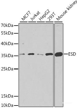 Immunohistochemistry of paraffin-embedded Human esophageal cancer using TUFM Polyclonal Antibody at dilution of  1:100 (40x lens).